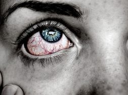 Herpes ocular