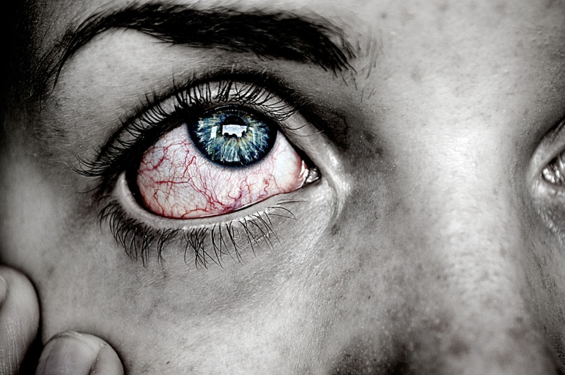 Sabe o que é herpes ocular? Esclareça todas as dúvidas com a nossa equipa!