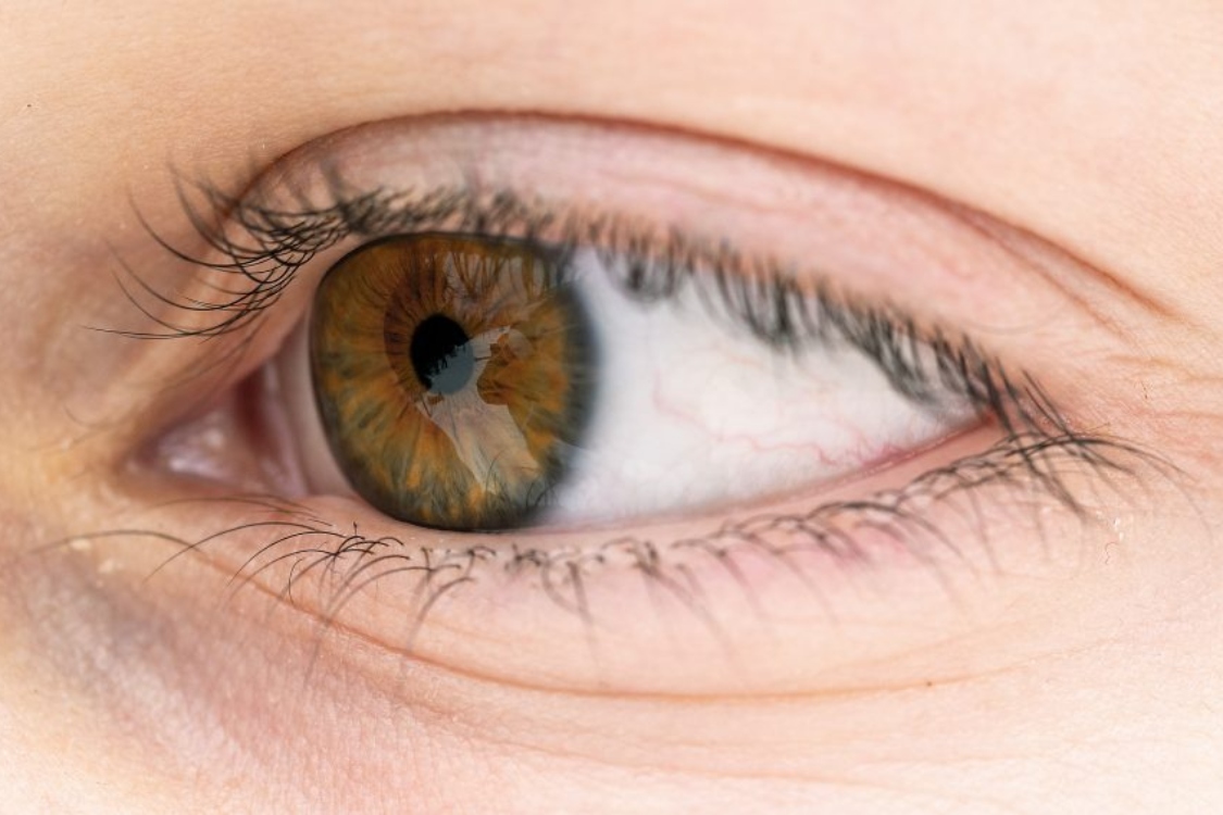 Ótica de criança: por que motivo surgem as ramelas nos olhos dos bebés?